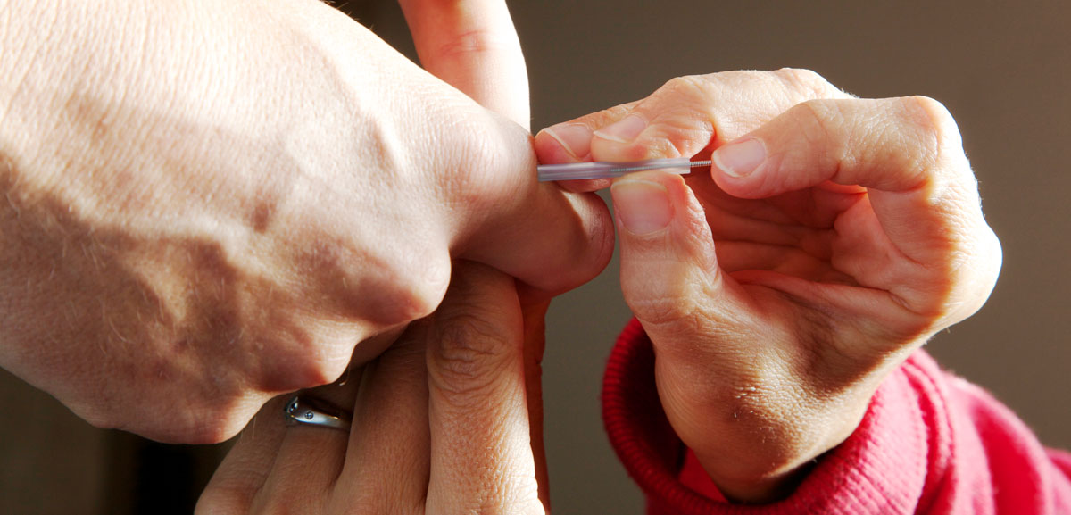 Community Acupuncture Sessions ($30/session)